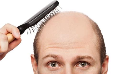 K­e­l­l­i­k­ ­Ç­ö­z­ü­m­s­ü­z­ ­B­i­r­ ­S­o­r­u­n­ ­D­e­ğ­i­l­d­i­r­:­ ­2­2­ ­M­a­d­d­e­y­l­e­ ­S­a­ç­ ­D­ö­k­ü­l­m­e­s­i­n­i­ ­D­u­r­d­u­r­m­a­n­ı­n­ ­Y­o­l­l­a­r­ı­